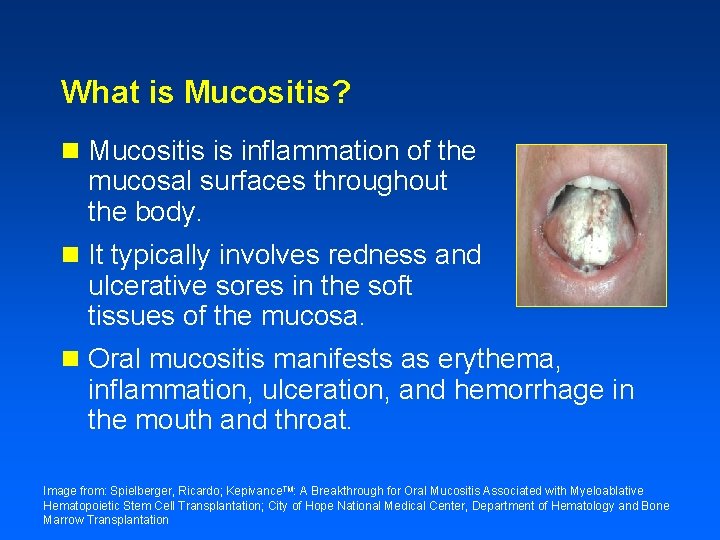 What is Mucositis? n Mucositis is inflammation of the mucosal surfaces throughout the body.