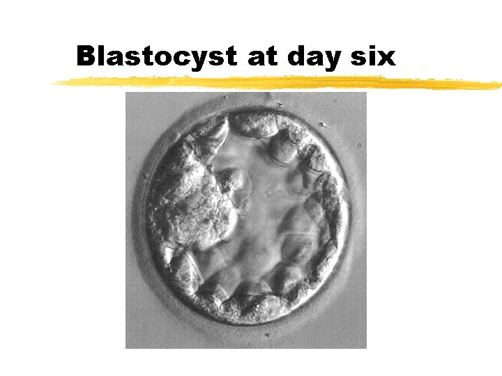 Blastocyst at day six 