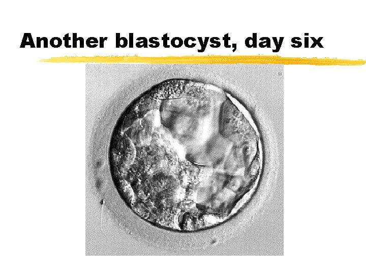 Another blastocyst, day six 
