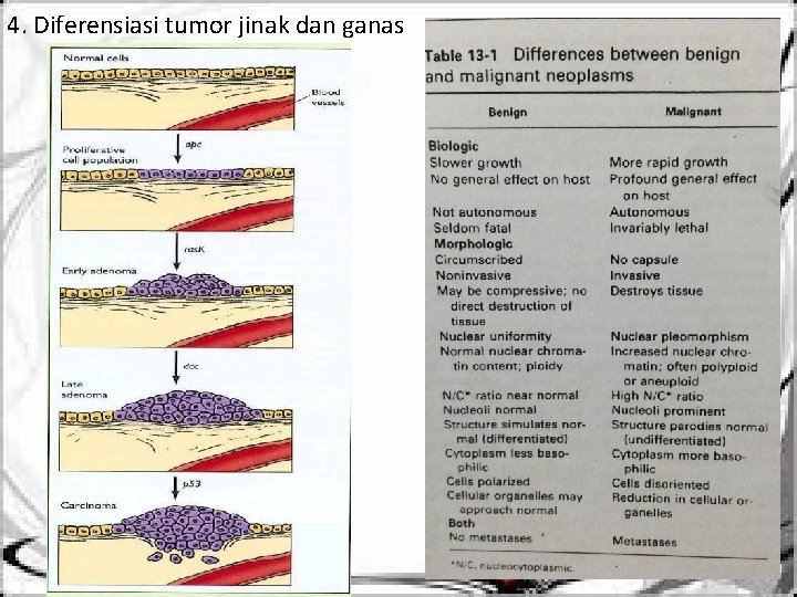4. Diferensiasi tumor jinak dan ganas 