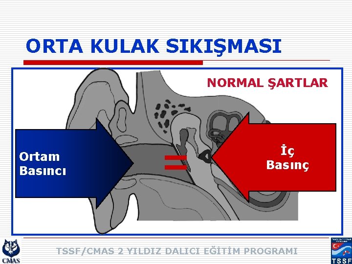 ORTA KULAK SIKIŞMASI NORMAL ŞARTLAR Ortam Basıncı = İç Basınç TSSF/CMAS 2 YILDIZ DALICI