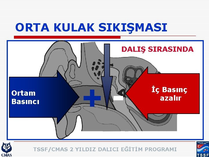 ORTA KULAK SIKIŞMASI DALIŞ SIRASINDA Ortam Basıncı +- İç Basınç azalır TSSF/CMAS 2 YILDIZ