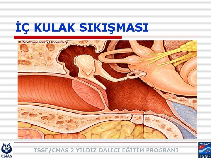 İÇ KULAK SIKIŞMASI TSSF/CMAS 2 YILDIZ DALICI EĞİTİM PROGRAMI 