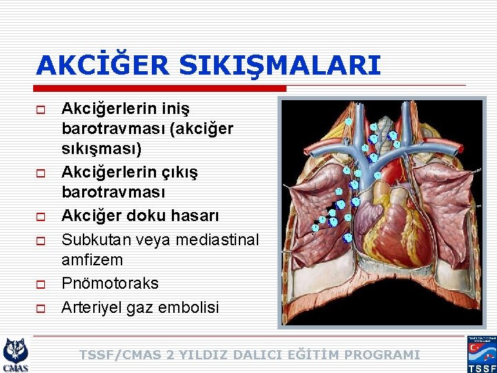 AKCİĞER SIKIŞMALARI o o o Akciğerlerin iniş barotravması (akciğer sıkışması) Akciğerlerin çıkış barotravması Akciğer