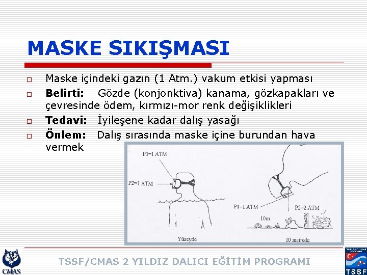 MASKE SIKIŞMASI o o Maske içindeki gazın (1 Atm. ) vakum etkisi yapması Belirti: