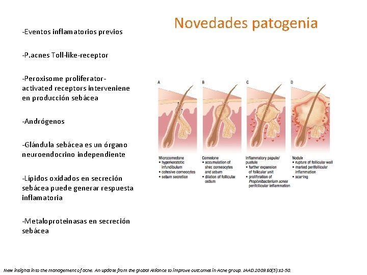 -Eventos inflamatorios previos Novedades patogenia -P. acnes Toll-like-receptor -Peroxisome proliferatoractivated receptors interveniene en producción