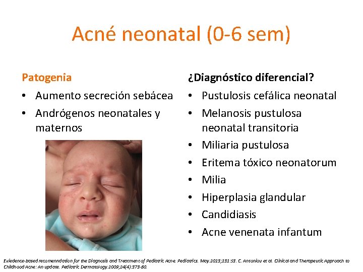 Acné neonatal (0 -6 sem) Patogenia ¿Diagnóstico diferencial? • Aumento secreción sebácea • Andrógenos