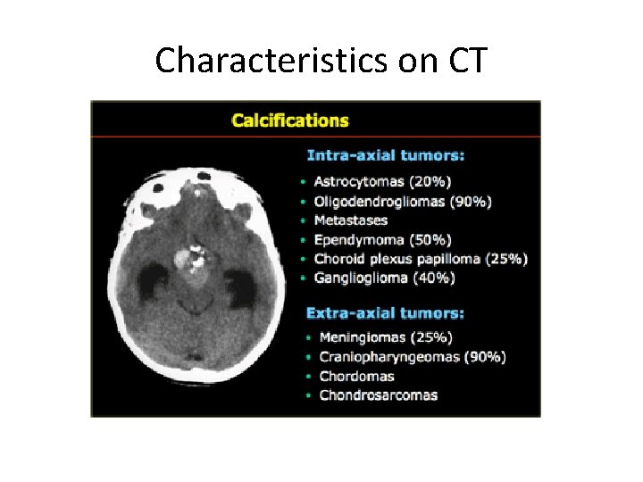 Characteristics on CT 