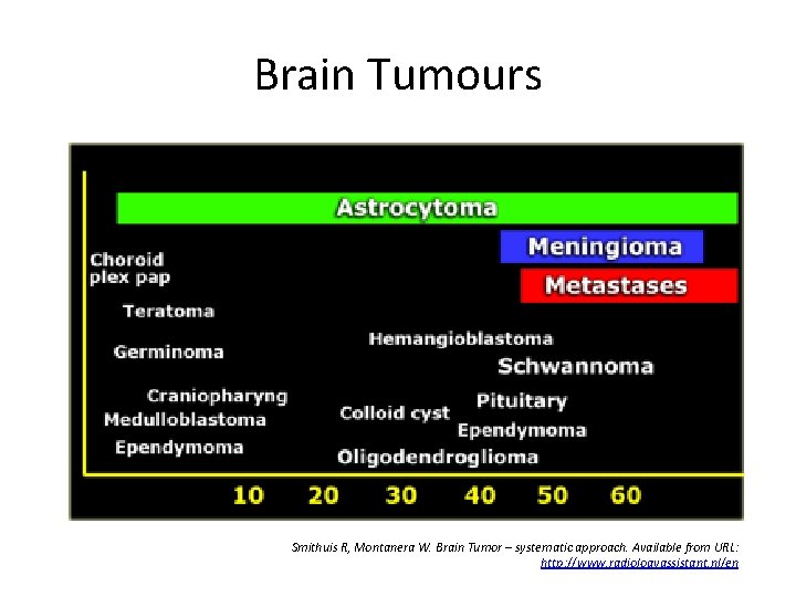 Brain Tumours Smithuis R, Montanera W. Brain Tumor – systematic approach. Available from URL: