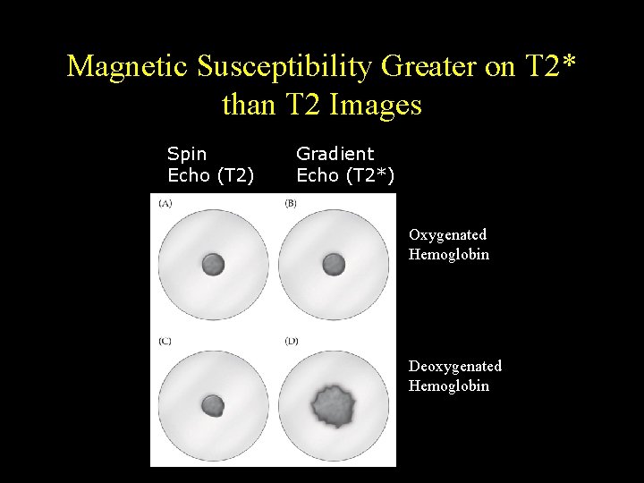 Magnetic Susceptibility Greater on T 2* than T 2 Images Spin Echo (T 2)