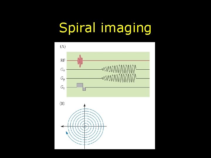 Spiral imaging 