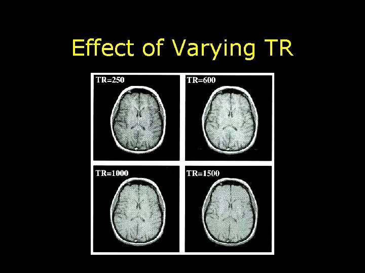 Effect of Varying TR 