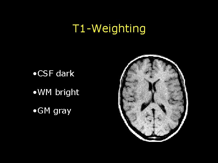 T 1 -Weighting • CSF dark • WM bright • GM gray 