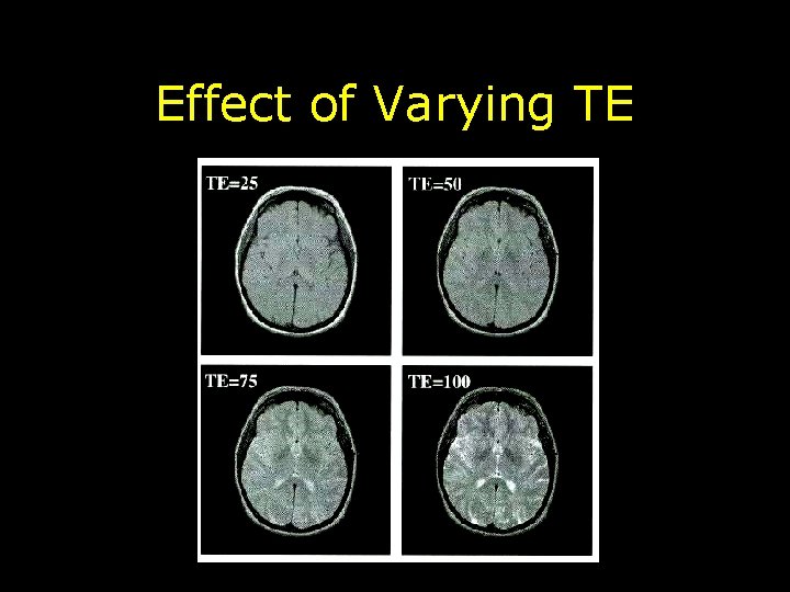 Effect of Varying TE 