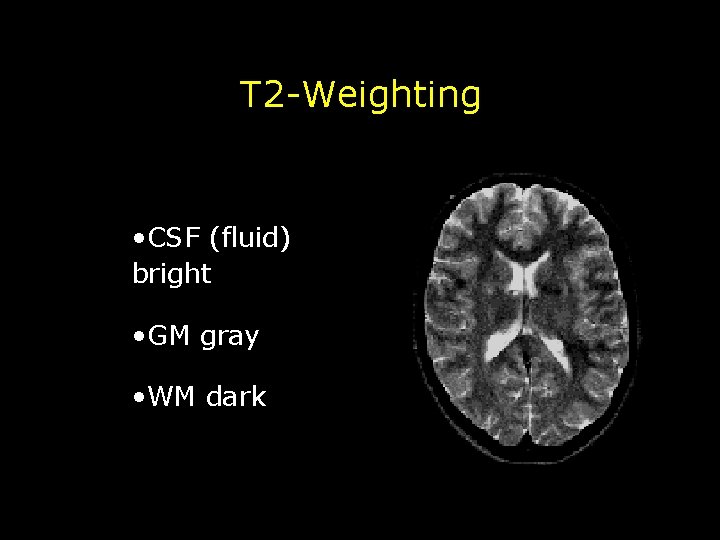 T 2 -Weighting • CSF (fluid) bright • GM gray • WM dark 