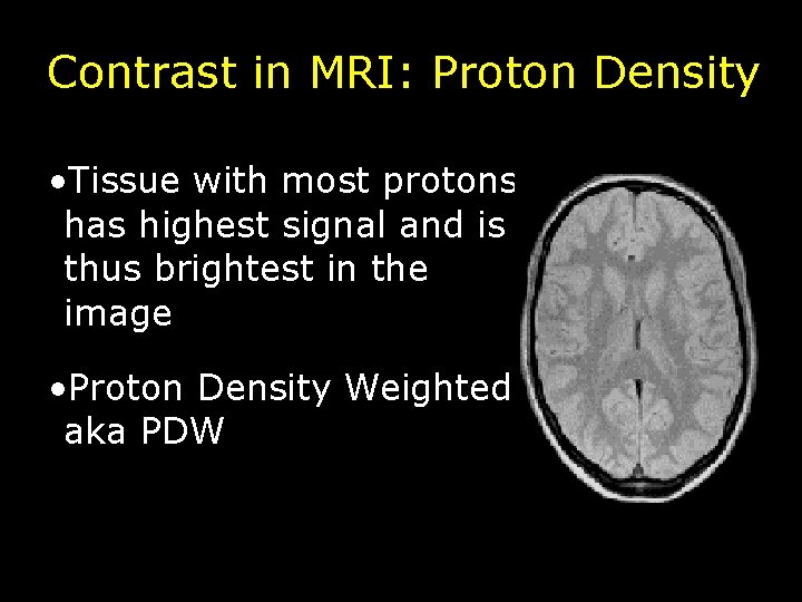 Contrast in MRI: Proton Density • Tissue with most protons has highest signal and