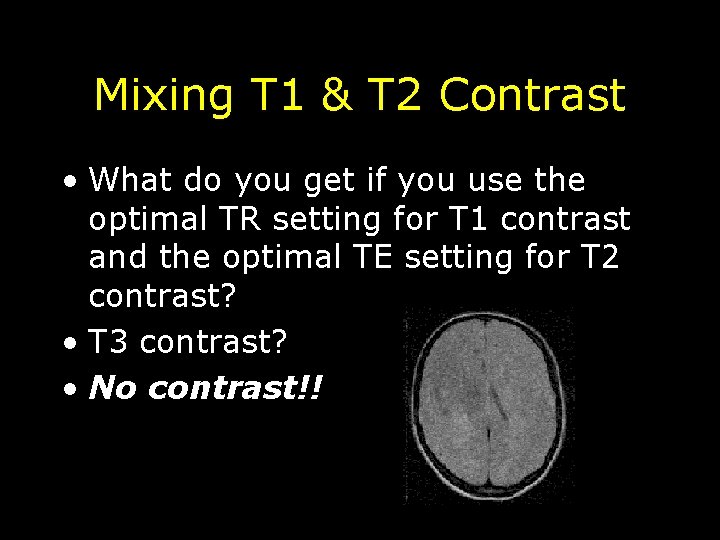 Mixing T 1 & T 2 Contrast • What do you get if you
