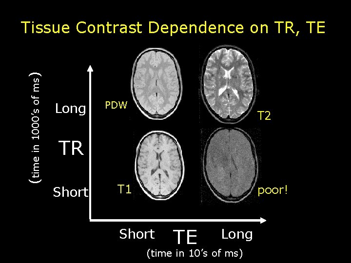 (time in 1000’s of ms) Tissue Contrast Dependence on TR, TE Long PDW T