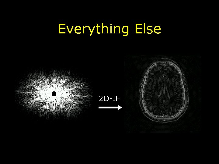 Everything Else 2 D-IFT 