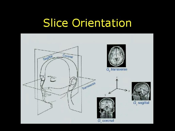 Slice Orientation 
