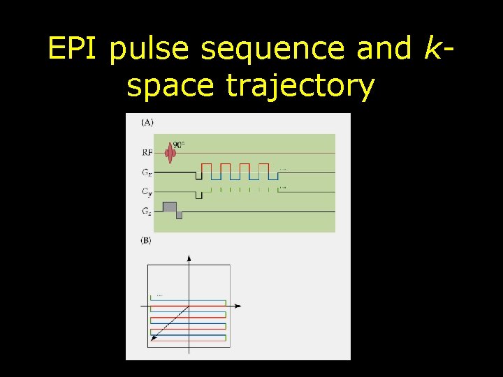 EPI pulse sequence and kspace trajectory 