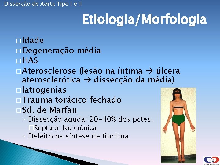 Dissecção de Aorta Tipo I e II Etiologia/Morfologia � Idade � Degeneração � HAS