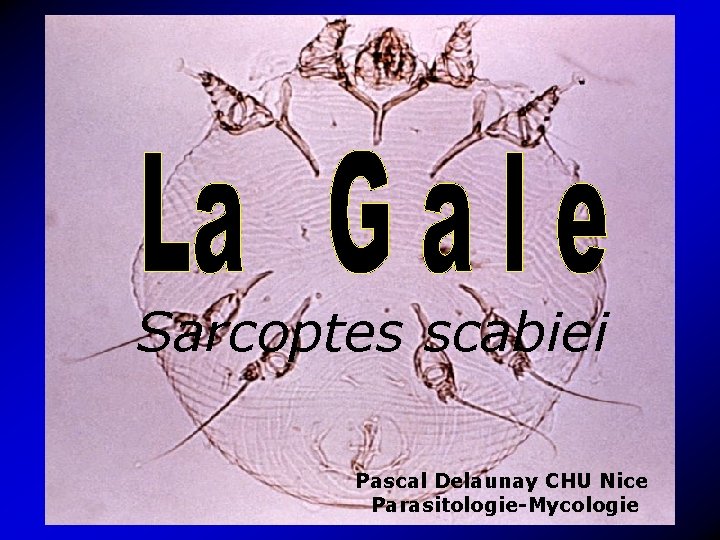 Sarcoptes scabiei Pascal Delaunay CHU Nice Parasitologie-Mycologie 