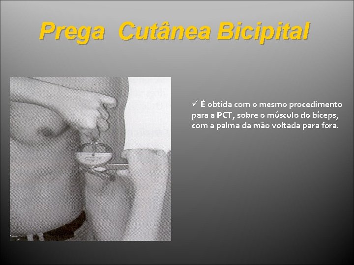 Prega Cutânea Bicipital ü É obtida com o mesmo procedimento para a PCT, sobre