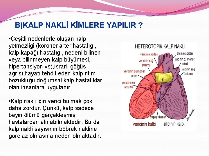 B)KALP NAKLİ KİMLERE YAPILIR ? • Çeşitli nedenlerle oluşan kalp yetmezliği (koroner arter hastalığı,