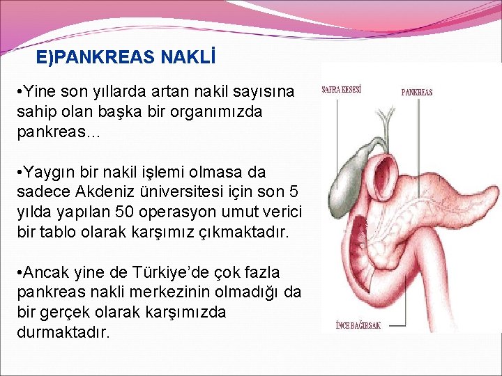 E)PANKREAS NAKLİ • Yine son yıllarda artan nakil sayısına sahip olan başka bir organımızda