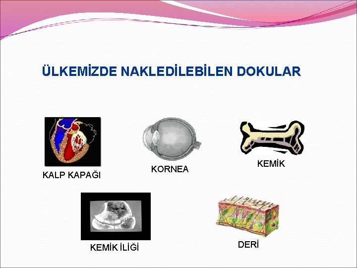ÜLKEMİZDE NAKLEDİLEBİLEN DOKULAR KALP KAPAĞI KEMİK İLİĞİ KORNEA KEMİK DERİ 
