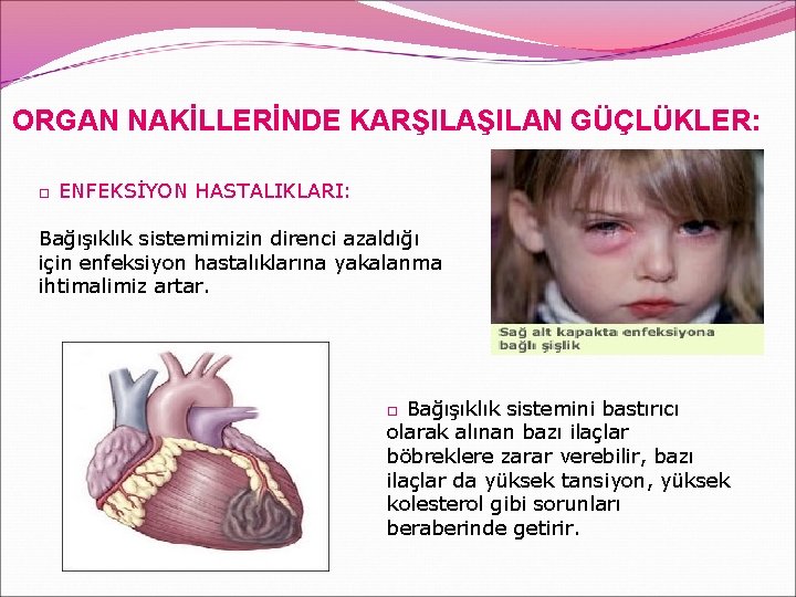 ORGAN NAKİLLERİNDE KARŞILAN GÜÇLÜKLER: □ ENFEKSİYON HASTALIKLARI: Bağışıklık sistemimizin direnci azaldığı için enfeksiyon hastalıklarına