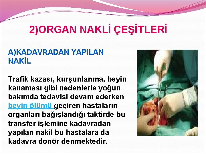 2)ORGAN NAKLİ ÇEŞİTLERİ A)KADAVRADAN YAPILAN NAKİL Trafik kazası, kurşunlanma, beyin kanaması gibi nedenlerle yoğun