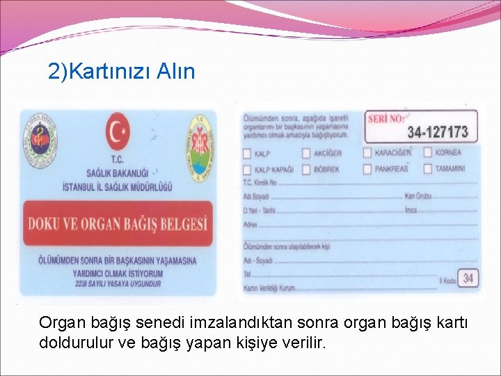 2)Kartınızı Alın Organ bağış senedi imzalandıktan sonra organ bağış kartı doldurulur ve bağış yapan