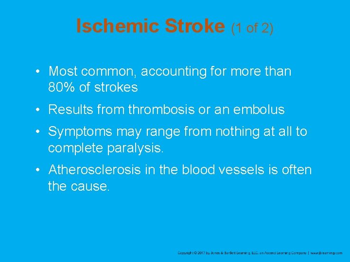 Ischemic Stroke (1 of 2) • Most common, accounting for more than 80% of