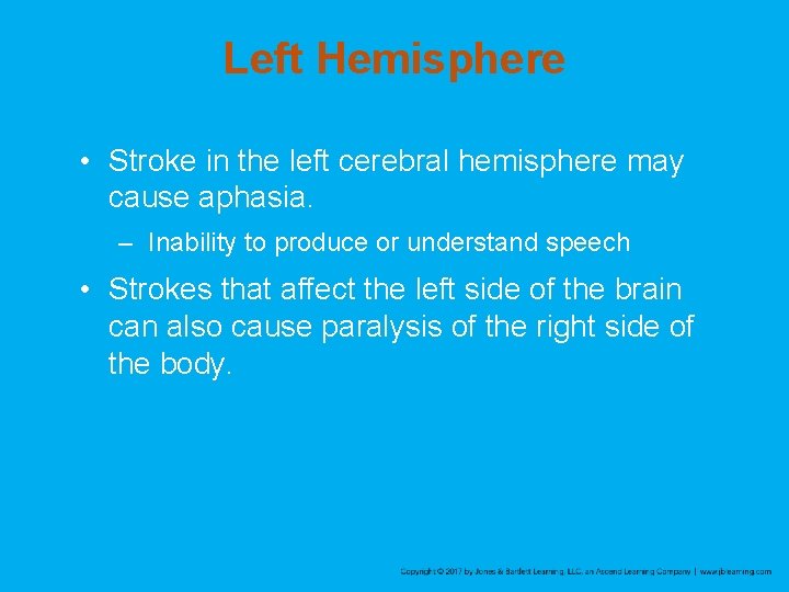 Left Hemisphere • Stroke in the left cerebral hemisphere may cause aphasia. – Inability