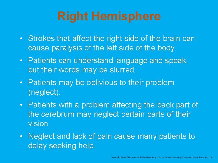 Right Hemisphere • Strokes that affect the right side of the brain cause paralysis