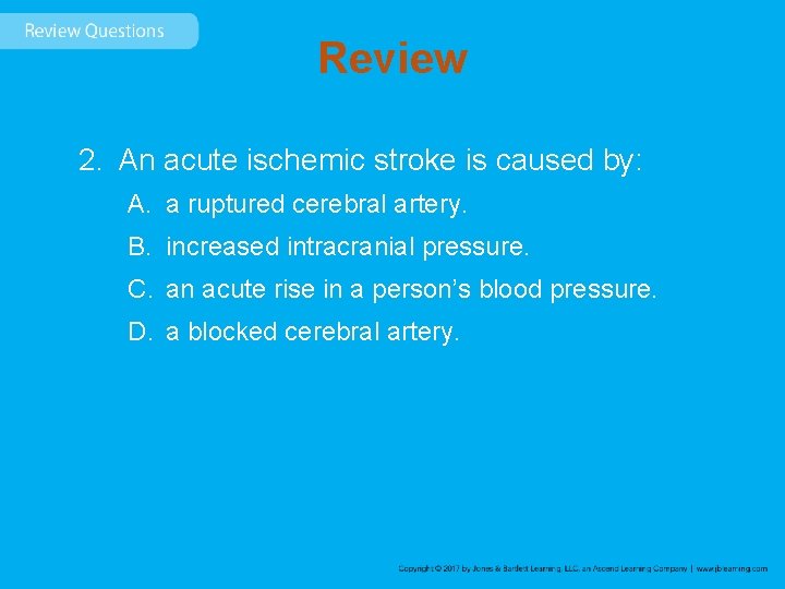 Review 2. An acute ischemic stroke is caused by: A. a ruptured cerebral artery.