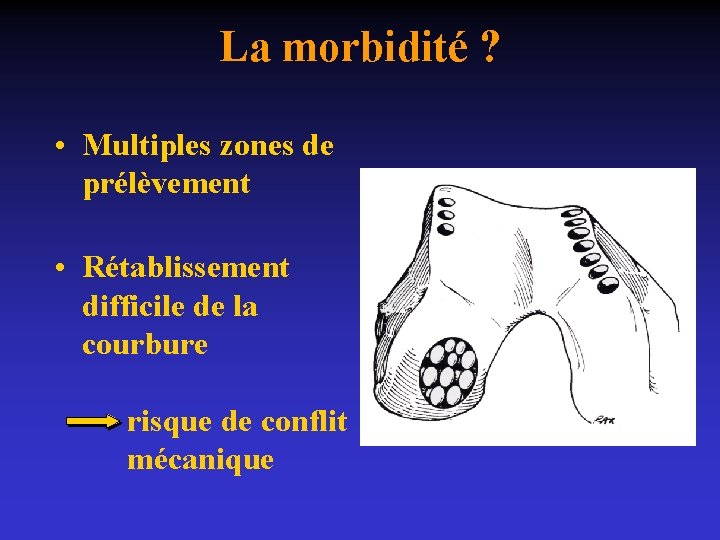 La morbidité ? • Multiples zones de prélèvement • Rétablissement difficile de la courbure