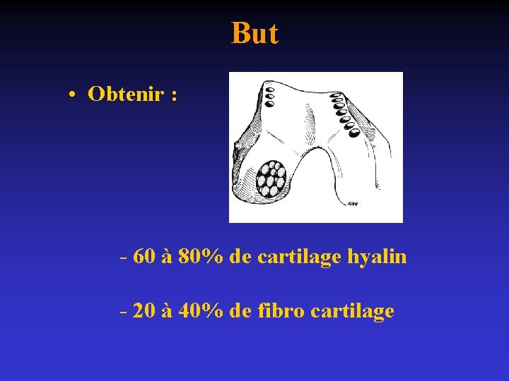But • Obtenir : - 60 à 80% de cartilage hyalin - 20 à