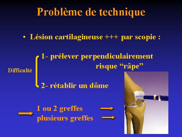 Problème de technique • Lésion cartilagineuse +++ par scopie : Difficulté 1 - prélever