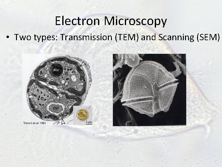 Electron Microscopy • Two types: Transmission (TEM) and Scanning (SEM) Electron Microscopy • Two types: Transmission (TEM) and Scanning (SEM)