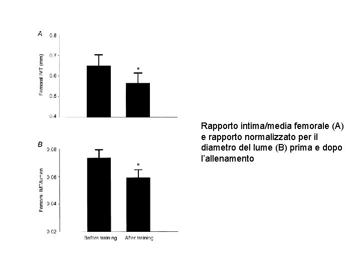 Rapporto intima/media femorale (A) e rapporto normalizzato per il diametro del lume (B) prima