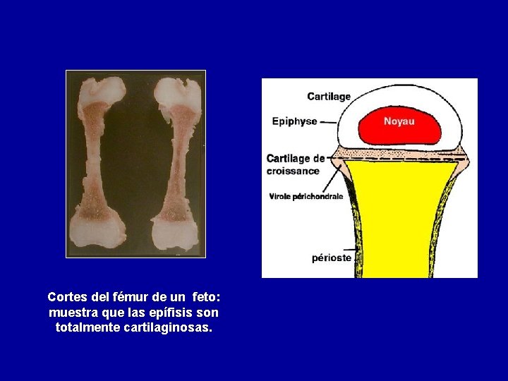 Cortes del fémur de un feto: muestra que las epífisis son totalmente cartilaginosas. 
