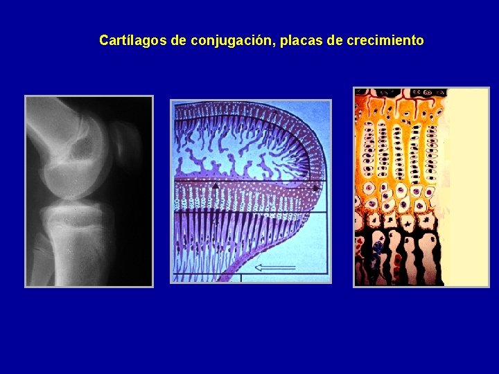 Cartílagos de conjugación, placas de crecimiento 
