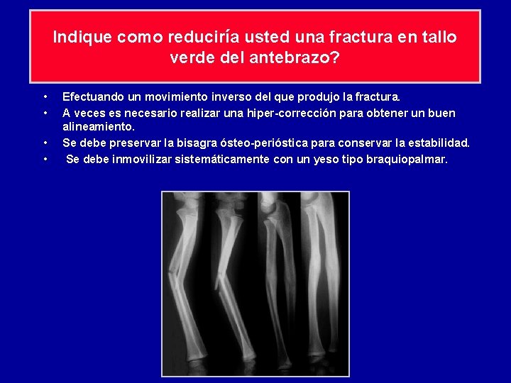Indique como reduciría usted una fractura en tallo verde del antebrazo? • • Efectuando