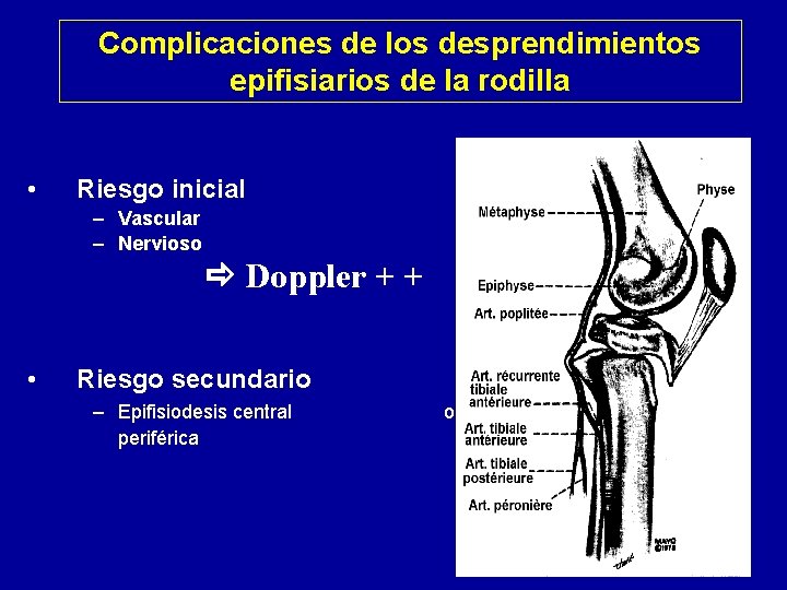 Complicaciones de los desprendimientos epifisiarios de la rodilla • Riesgo inicial – Vascular –