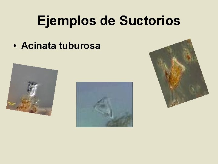 Ejemplos de Suctorios • Acinata tuburosa 