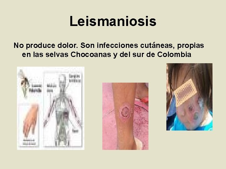 Leismaniosis No produce dolor. Son infecciones cutáneas, propias en las selvas Chocoanas y del