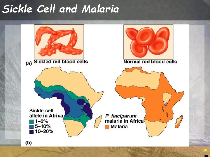 Sickle Cell and Malaria 30 30 Sickle Cell and Malaria 30 30
